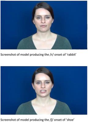 Speechreading in Deaf Adults with Cochlear Implants: Evidence for Perceptual Compensation